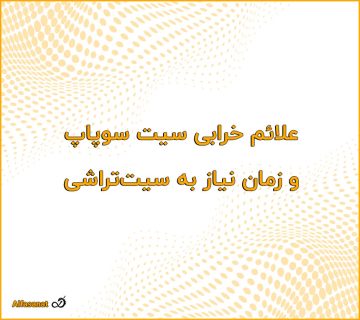علائم خرابی سیت سوپاپ و زمان نیاز به سیت‌تراشی